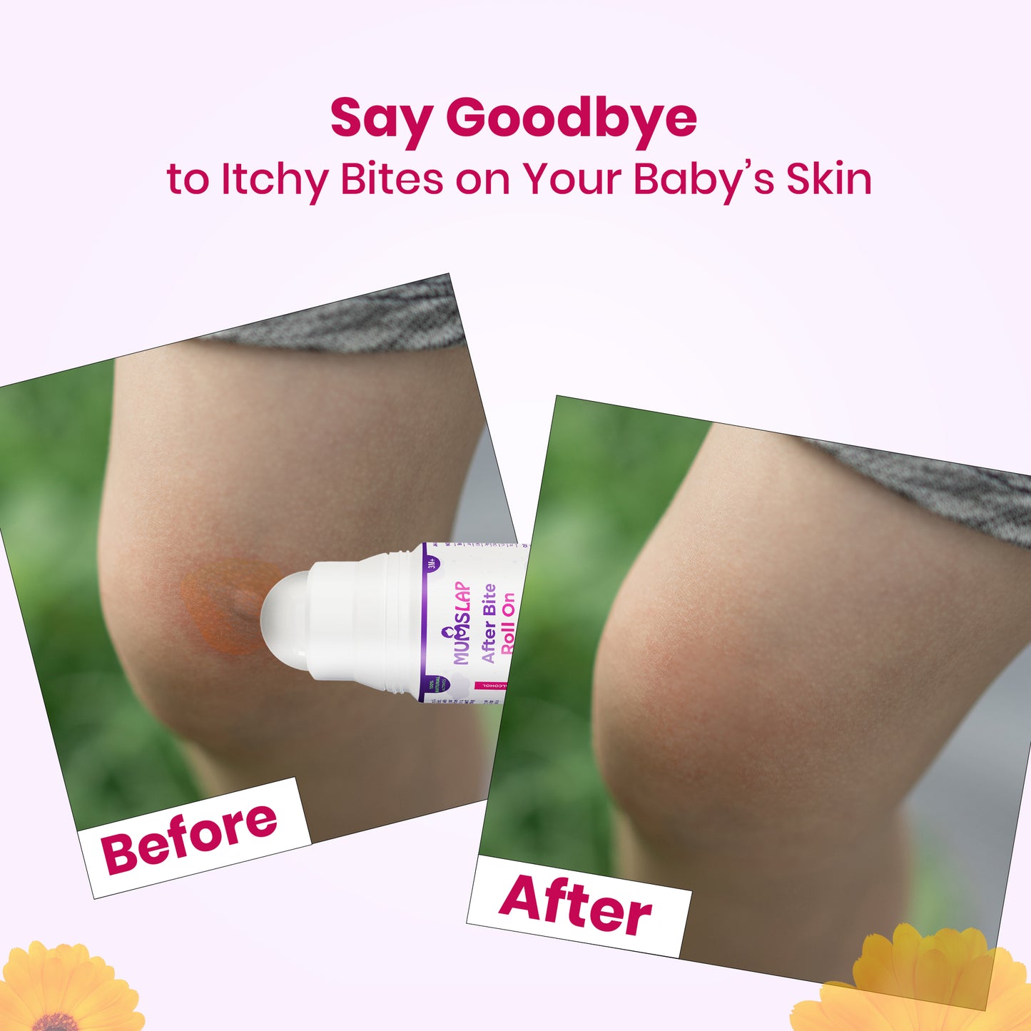 After Bite Roll On For Rashes & Mosquito Bites with Lavander And Gandhpura Oils
