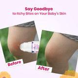 After Bite Roll On For Rashes & Mosquito Bites with Lavander And Gandhpura Oils